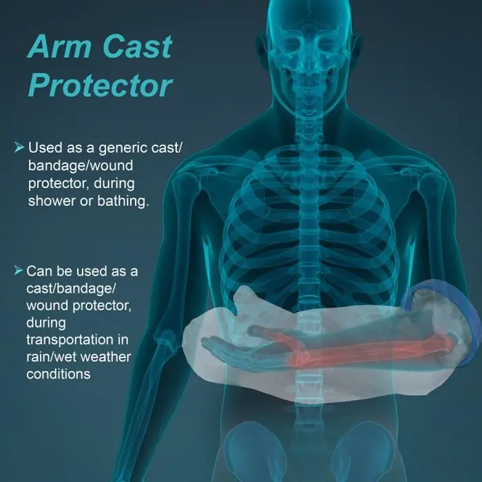 c_19 Cast Cover (Arm) 1